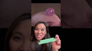 Dr Pimple Popper Explains Forehead Growth [upl. by Attenod388]