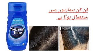 selsun blue shampoo uses complete review [upl. by Oirad539]