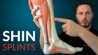 Understanding SHIN SPLINTS and how to fix it [upl. by Malcolm]