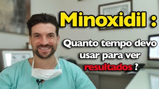 Minoxidil quanto tempo devo usar para ter resultado [upl. by Onailime466]