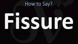 How to Pronounce Fissure CORRECTLY [upl. by Aicilegna]