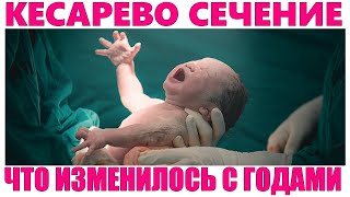 КЕСАРЕВО СЕЧЕНИЕ  Быстрое восстановление после кесарева сечения [upl. by Lek552]