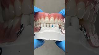 Upper Denture and Lower Partial lsk121shorts dentistteeth dentistry [upl. by Ogram]