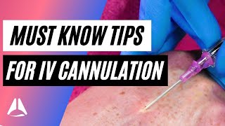 Important tips and tricks for IV cannulation [upl. by Anrym]