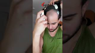 Instalación de prótesis capilar para hombre de encaje frances  Lordhair [upl. by Adnical925]