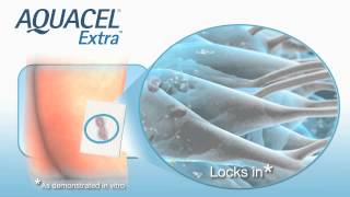 The Benefits of AQUACEL Extra Dressing [upl. by Gallard222]