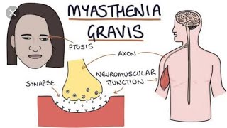 Role of Neostigmine in the treatment of Myasthenia Gravis [upl. by Selden]