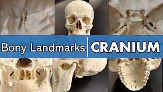 Bony landmarks of the cranium [upl. by Bette]