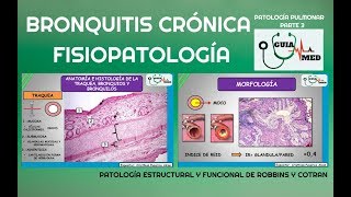 EPOC BRONQUITIS CRÓNICA FISIOPATOLOGÍA  GuiaMed [upl. by Suivatnom]