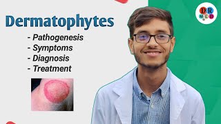 Dermatophytosis  Cutaneous mycosis  Dermatophytes  Microbiology bangla lecture [upl. by Bhatt]