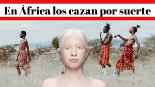 【Albino】¿Por que en África desviven a los Albinos [upl. by Johnette]