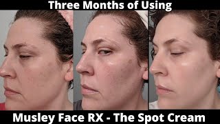 Musely Face RX Review  The Spot Cream [upl. by Sallee]