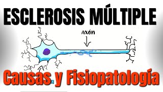 Esclerosis múltiple CAUSAS y FISIOPATOLOGÍA  P1 [upl. by Mischa]