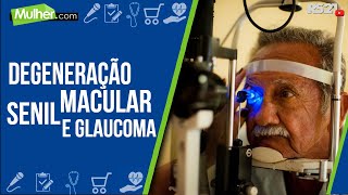 Entenda tudo sobre Degeneração Macular Senil e Glaucoma  RedeSeculo21  Mulhercom  19102021 [upl. by Luby]