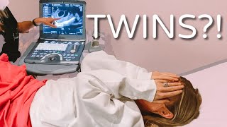 SHOCKING ULTRASOUND TWINS  LAUREN amp ARIE [upl. by Schulman]