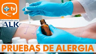 ¿Cómo se realizan las pruebas de alergia [upl. by Ttiwed54]