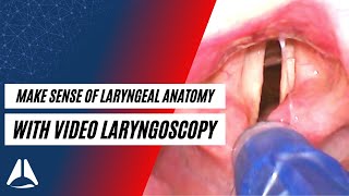 How to make sense of laryngeal anatomy with a video laryngoscope  ABCS of Anaesthesia Foundations [upl. by Kurtzig]