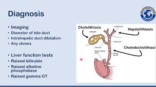 choledocholithiasis Surgery By Dr Awais Shuja Class Final Year [upl. by Mathew]