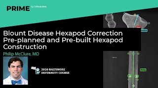 Blount Disease Hexapod Correction Pre planned and Pre built Hexapod Construction Philip McClure M [upl. by Shelah590]