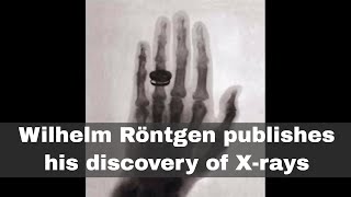 28th December 1895 Wilhelm Röntgen publishes his discovery of Xrays [upl. by Aihsyak560]