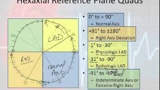 12 Lead Interpretation Part 3 Rwave Progression Electrical Vectors amp Axis Deviations [upl. by Eichman]