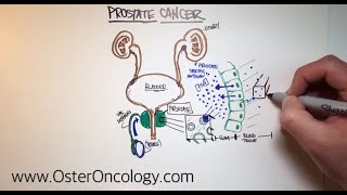 What to Expect Before Starting Radiation Treatment for Prostate Cancer [upl. by Lamrouex381]