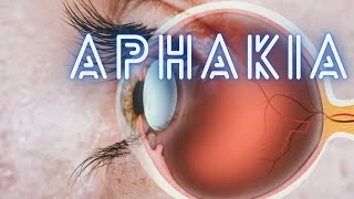 Aphakia  Ophthalmology Lecture [upl. by Arehsat943]