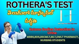 ROTHERAS TEST KETONE BODIES DETECTION IN URINE in telugu manual method [upl. by Homere]