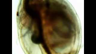 Daphnia Heart Rate Diphenhydramine [upl. by Eamon]