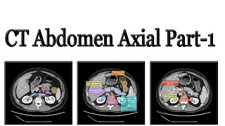 How to Read a CT Scan Chest  A Radiologists Approach [upl. by Alil265]