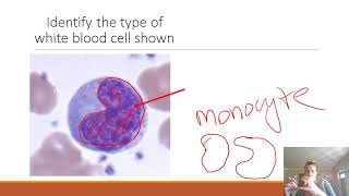 AP II Practice Lab Exam 1 Blood amp Heart [upl. by Atnod378]