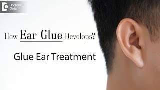 Glue ear treatment  How Glue Ear develops [upl. by Marcoux428]