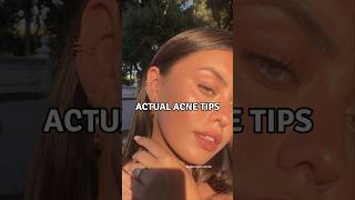 6 Actual Acne Tips viralshorts acnetreatment acnescars [upl. by Erline]