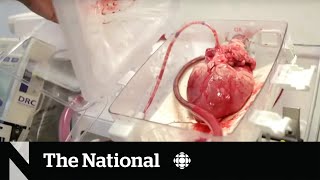 Heart transplants may soon be more accessible thanks to heartinabox tech [upl. by Ahsener]