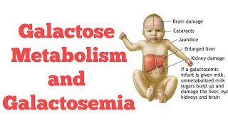 Galactose metabolism  Biochemistry [upl. by Eniamret]