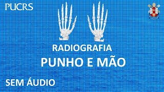 61 Diagnóstico radiografia punho e mão  sem áudio  Hand and wrist radiography [upl. by Aziul]