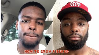 How to Grow a Beard  UPDATE Minoxidil [upl. by Hehre]