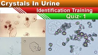 Crystals In Urine Identification Training Quiz  Part 15 [upl. by Aisatsanna]