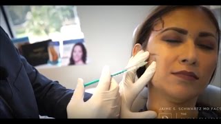 Botox Treatment for TMJ Pain [upl. by Tiffani]