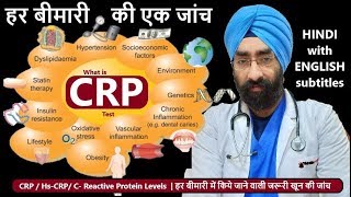 CRP Test in hindi  CReactive Protein  CRP Test Procedure  pathology lab [upl. by Novikoff408]