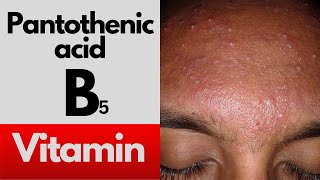 Vitamin B5 Pantothenic acid deficiency symptoms food sources and benefits of the B5 vitamin [upl. by Retswerb]