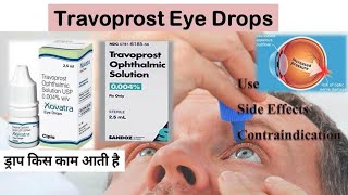 Travoprost Eye Drops  travoprost ip drops [upl. by Aicenra]