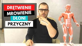 MROWIENIE I DRĘTWIENIE DŁONI  TOP 3 przyczyny ucisku na nerw [upl. by Shauna]