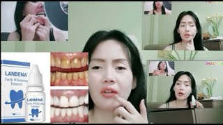 LANBENA Teeth Whitening Essence Review [upl. by Gnilsia365]