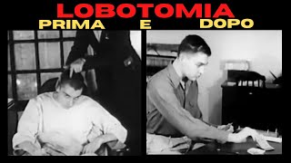 LOBOTOMIA prima e dopo [upl. by Llesirg]