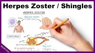 Herpes ZosterShingles Symptoms Diagnosis Treatment [upl. by Mendoza163]