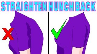 The 4 minute solution to correct hunchback kyphosis [upl. by Devina]