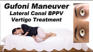 Gufoni Maneuver to Treat BPPV of the Lateral Canal Ageotropic and Geotropic Variations [upl. by Sillihp]