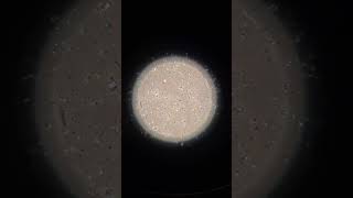 Inside the Lab Sperm Under the Microscope EmbryologyInsights [upl. by Eislel21]