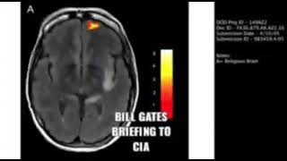 Shocking 🔥In the secret presentation to CIA Bill gates is talking about diff parts of brain [upl. by Alac737]